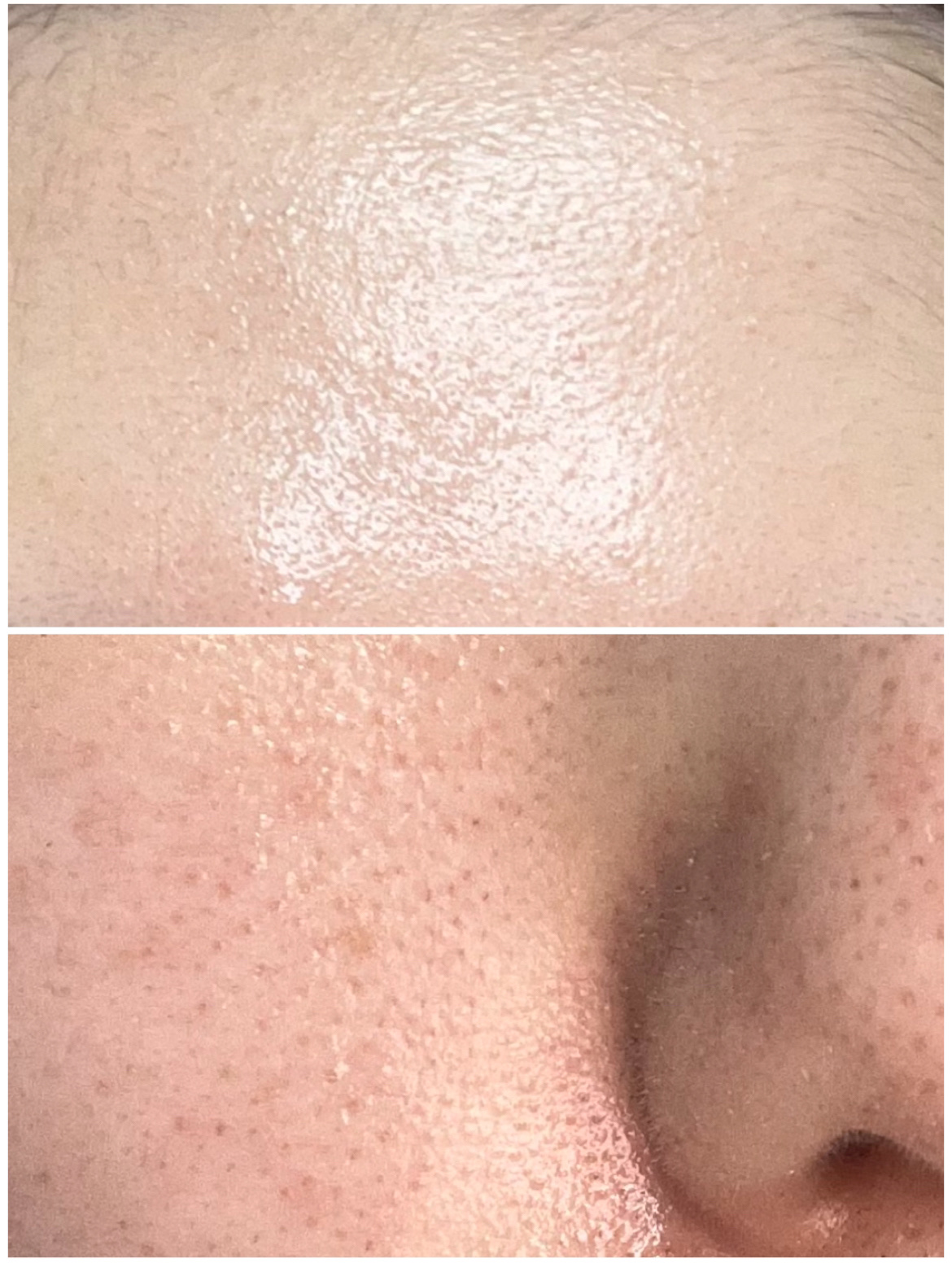 RMK Wトリートメントオイル/RMK/ブースター・導入液を使ったクチコミ（2枚目）