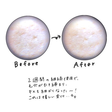 シカレチA エッセンス0.1/VT/美容液を使ったクチコミ(4枚目)