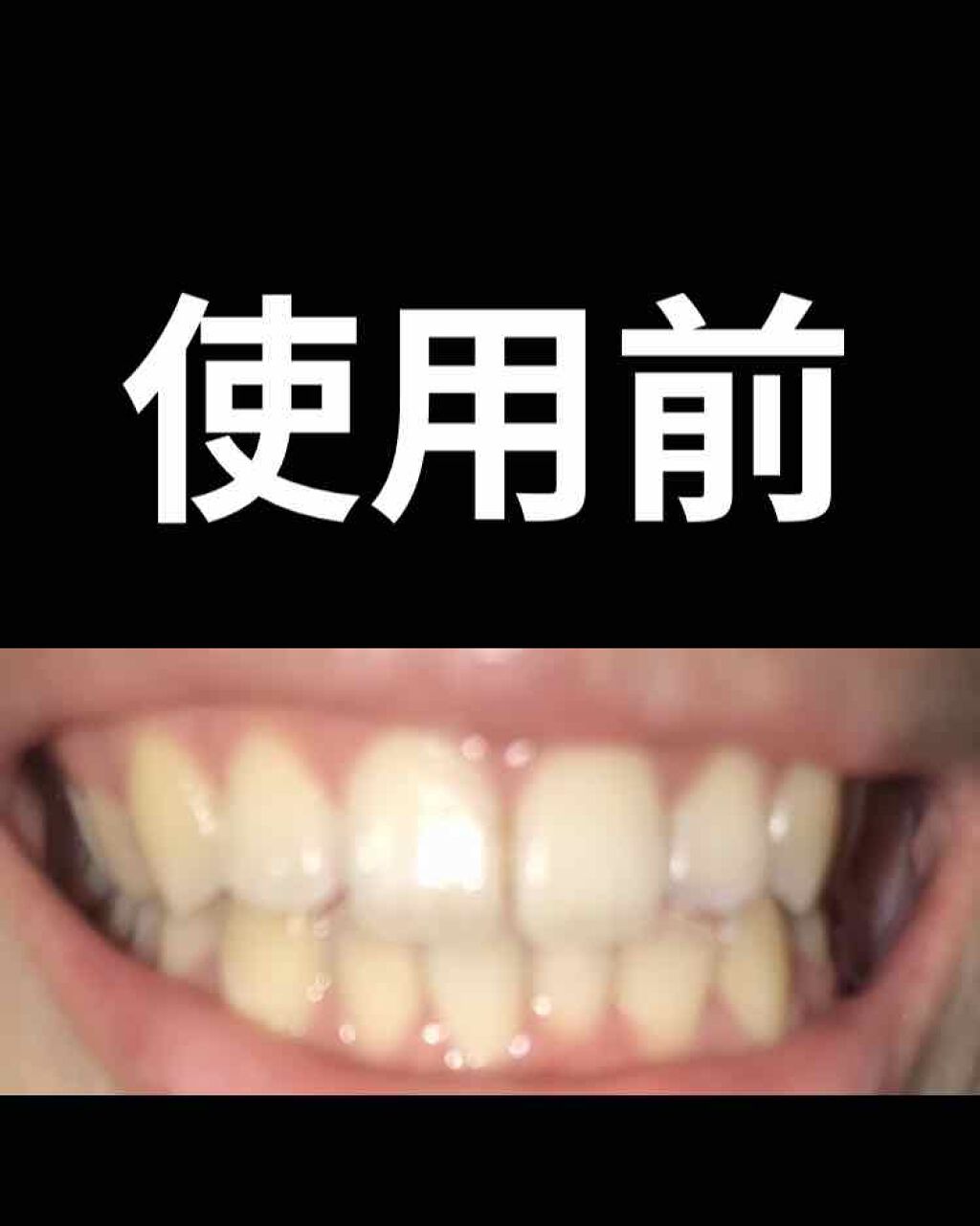 デンティス　チューブタイプ ポンプタイプ 120g/デンティス/歯磨き粉を使ったクチコミ（2枚目）