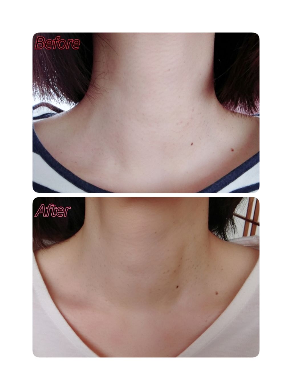 大人の美くびクリーム/ハリーハリー/ネック・デコルテケアを使ったクチコミ(4枚目)