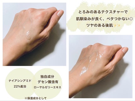 RJスペシャルコンク/アピセラピーコスメティクス/美容液を使ったクチコミ(3枚目)