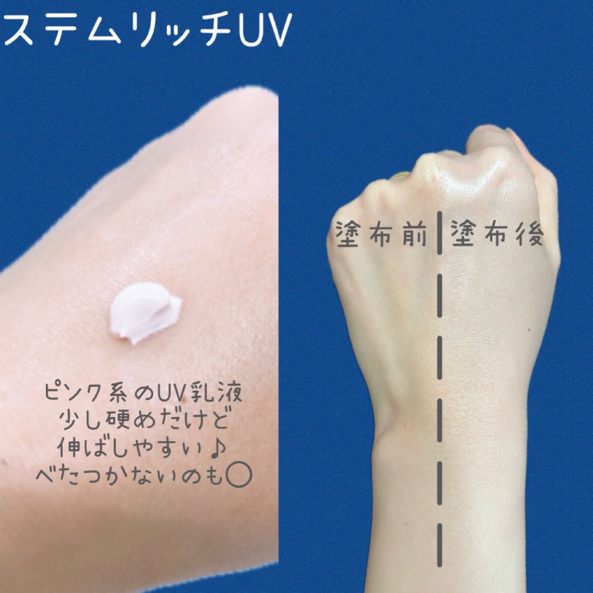 ステムリッチミルク/リスタ/乳液を使ったクチコミ(4枚目)