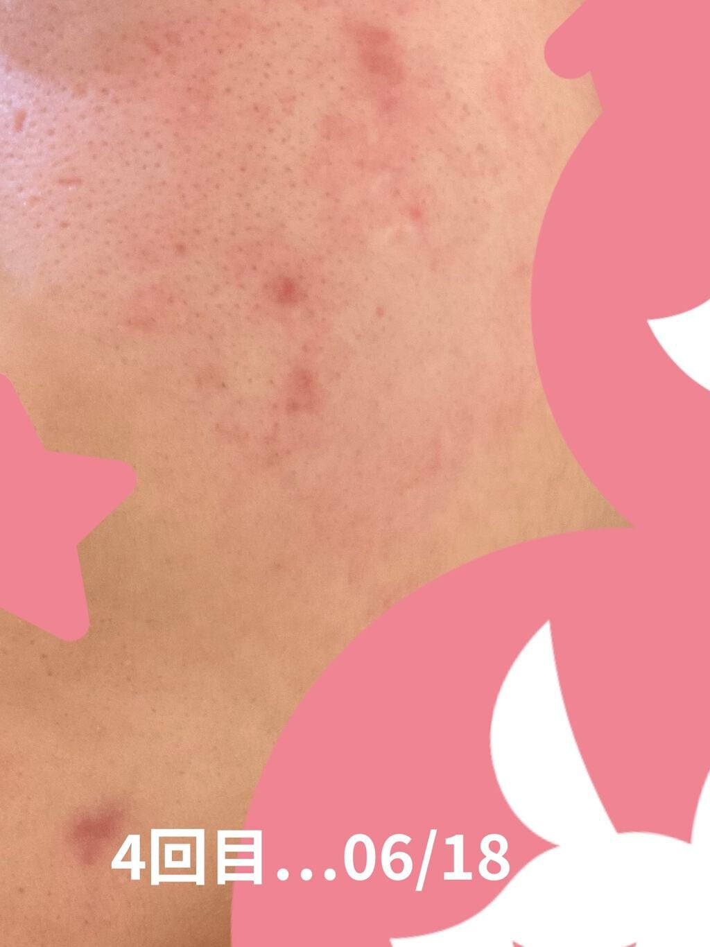 薬用しみ対策 美白化粧水 しっとりタイプ/メラノCC/化粧水を使ったクチコミ(2枚目)