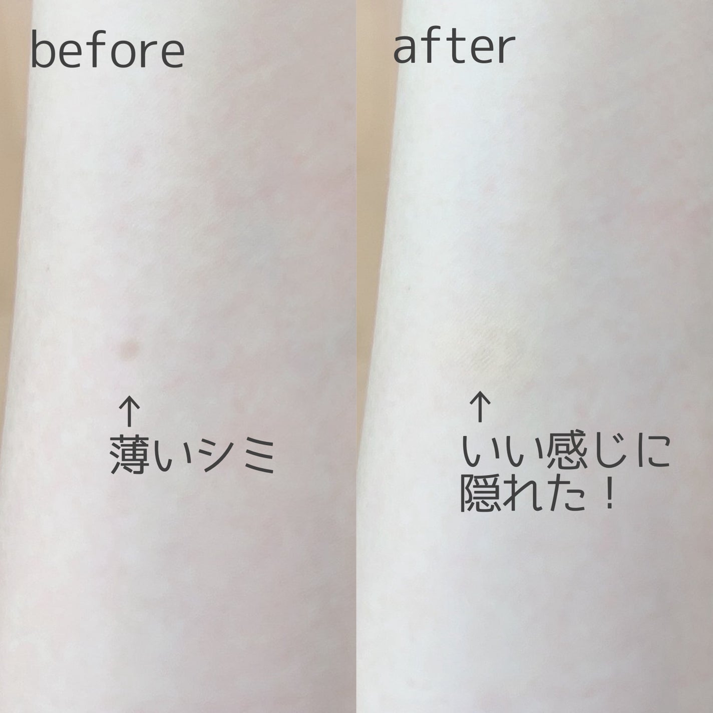 TIMAGE クリーミーコンシーラーパレット/TIMAGE/パレットコンシーラーを使ったクチコミ(5枚目)