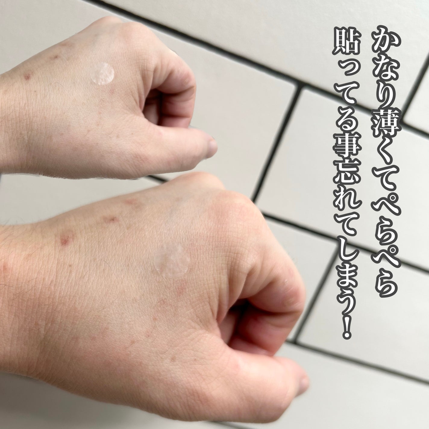 極薄透明パッチ nikipa!/金冠堂/にきびパッチを使ったクチコミ(3枚目)