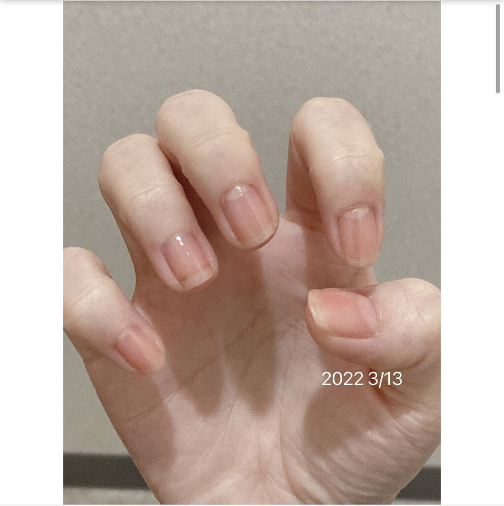 アロマキューティクルオイル/D-UP/ネイルオイル・トリートメントを使ったクチコミ（3枚目）