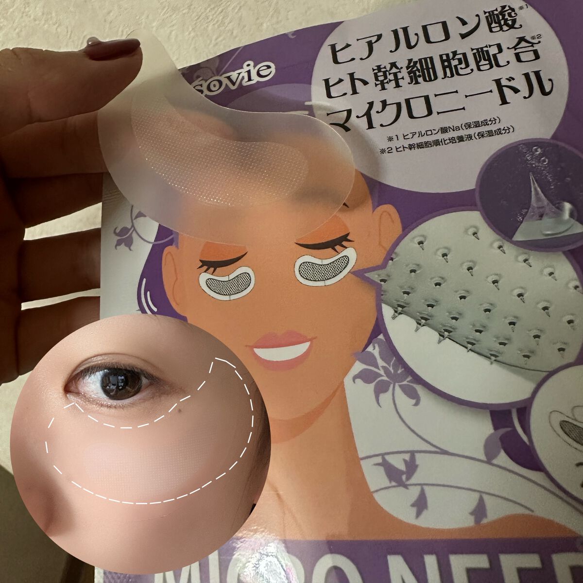 を使ったクチコミ（2枚目）