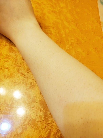 除毛クリームキット敏感肌用/エピラット/除毛クリームを使ったクチコミ(3枚目)