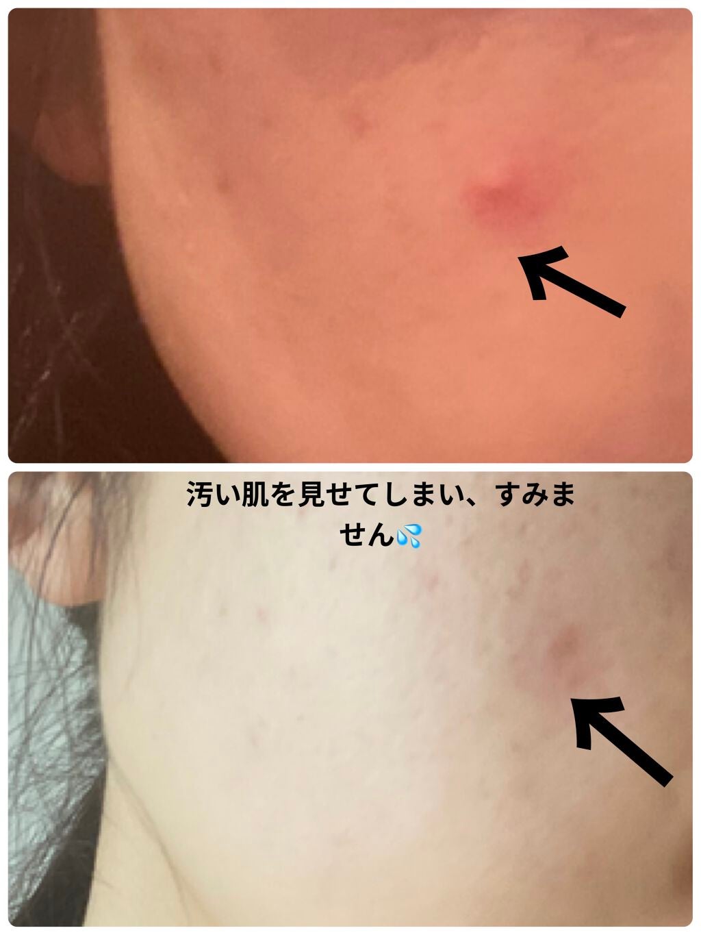 レッド プロポリス エキスパート アンプル/CNP Laboratory/美容液を使ったクチコミ(7枚目)