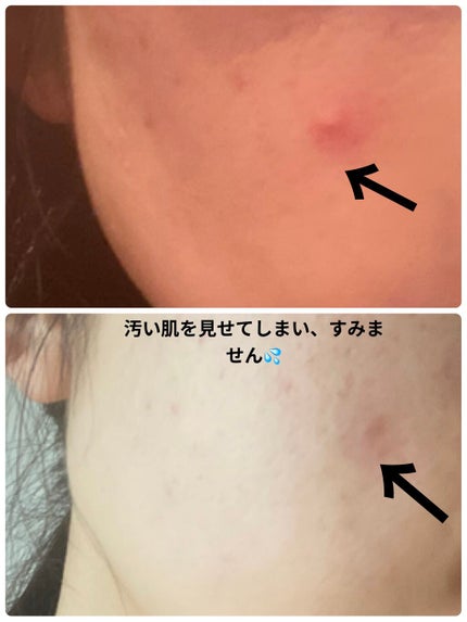 レッド プロポリス エキスパート アンプル/CNP Laboratory/美容液を使ったクチコミ(7枚目)