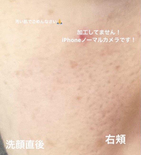 泡洗顔 ブライトアップ/ビフェスタ/泡洗顔を使ったクチコミ(5枚目)