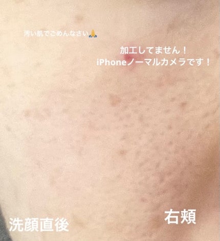 泡洗顔 ブライトアップ/ビフェスタ/泡洗顔を使ったクチコミ(5枚目)