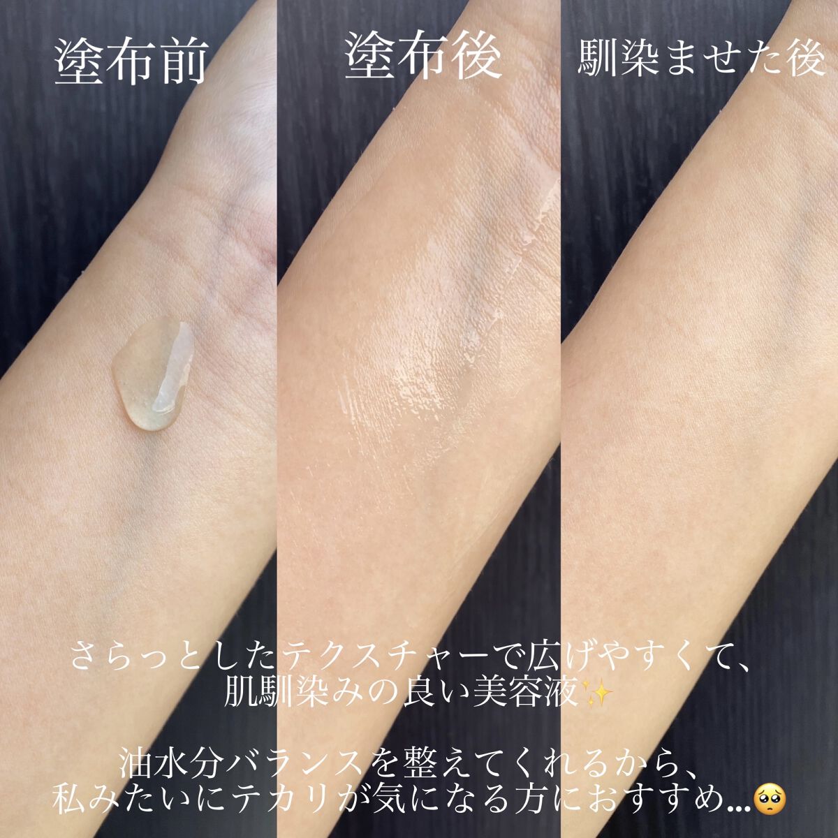 グリーンカーミングブルーレーションクリーンアンプル/obsero/美容液を使ったクチコミ（2枚目）