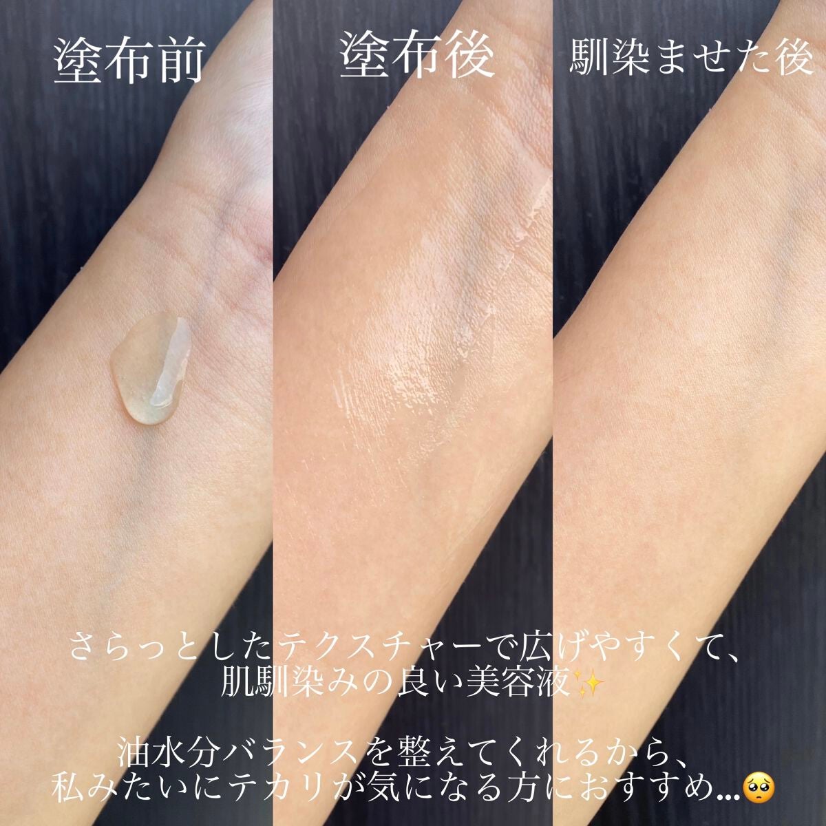 グリーンカーミングブルーレーションクリーンアンプル/obsero/美容液を使ったクチコミ(2枚目)