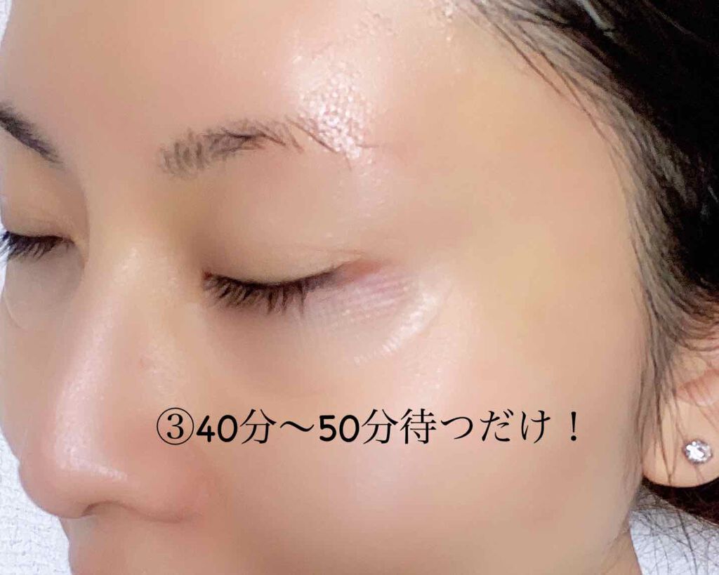 さささ on LIPS 「実はシミ、シワの集中ケアしてました。2週間ほど経ったのでレポし..」(4枚目)