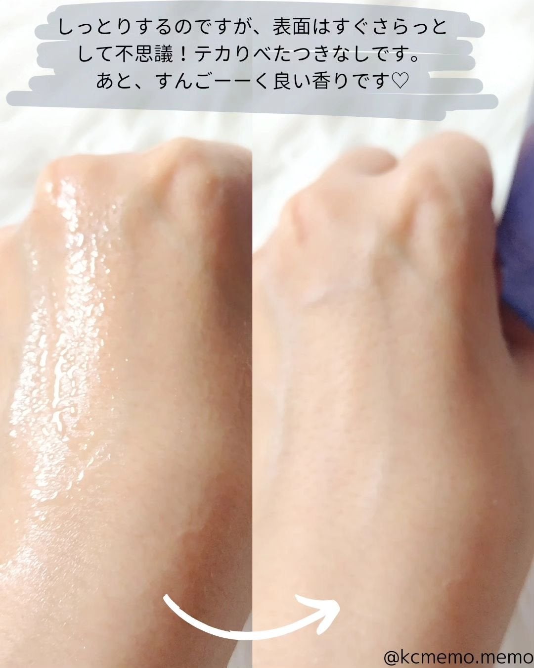 ブラックスネイル クリーム/Dr.G/フェイスクリームを使ったクチコミ(9枚目)