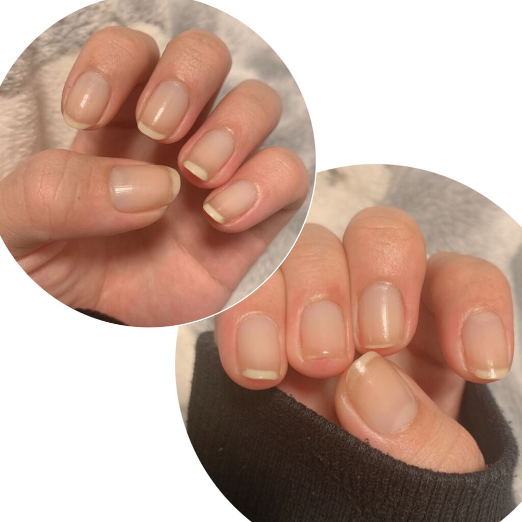 ネイルエンビー/O・P・I/ネイルオイル・トリートメントを使ったクチコミ(2枚目)