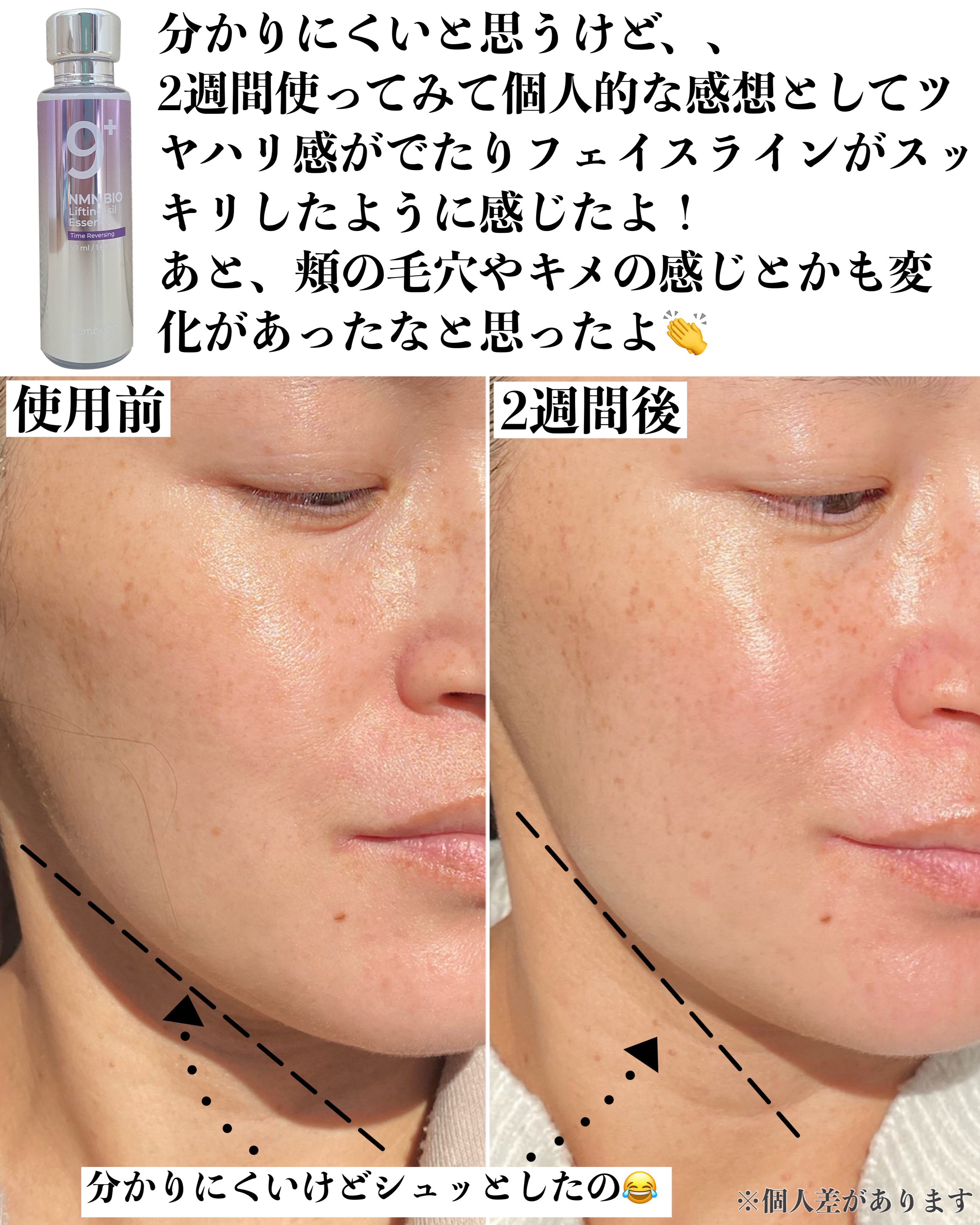 9番 NMNバイオリフト濃縮美容液｜numbuzinの効果に関する口コミ