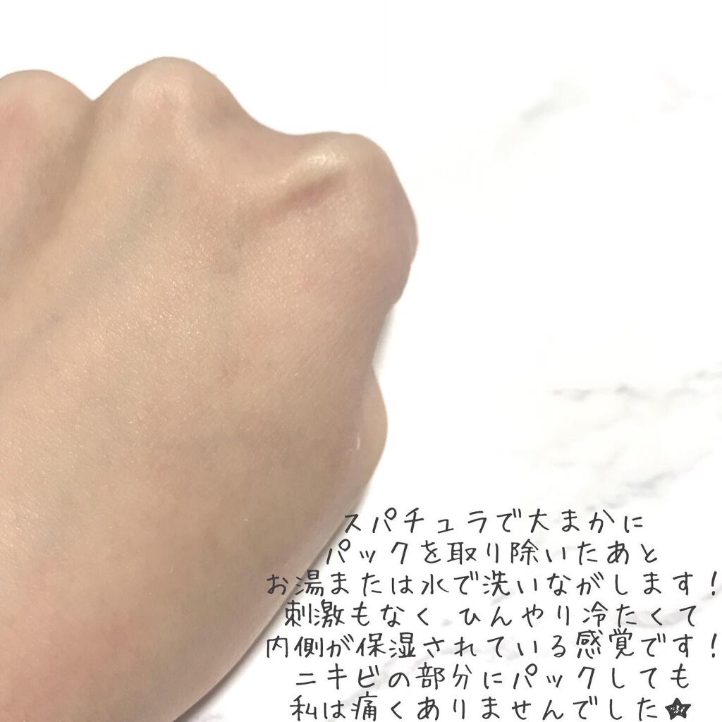 スパークリングパック/Urar /シートマスク・パックを使ったクチコミ(10枚目)