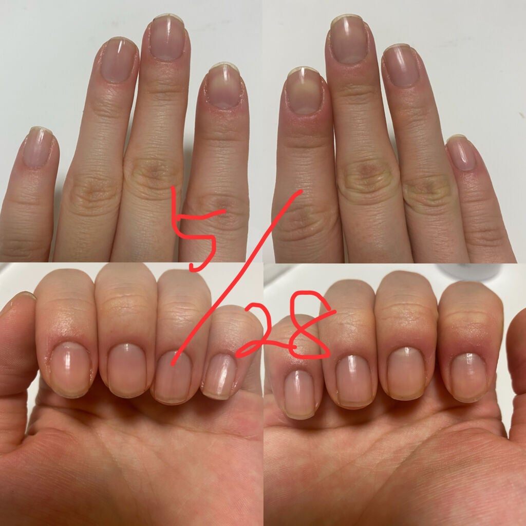 Ø on LIPS 「育爪絶対退化した。。ネイルオイルサボった時期あったからその時期..」(2枚目)