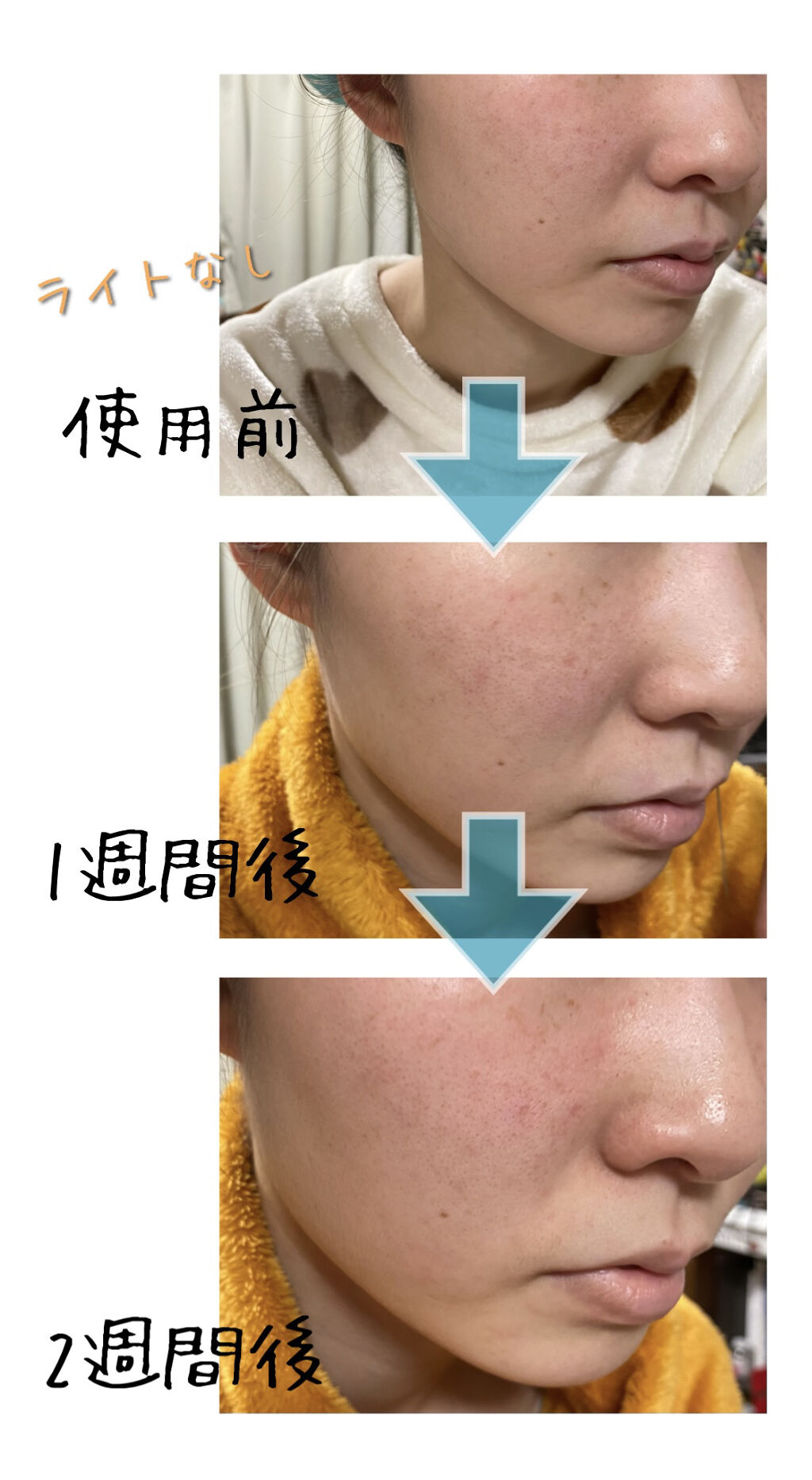 カワラヨモギ化粧水/ONE THING/化粧水を使ったクチコミ（3枚目）