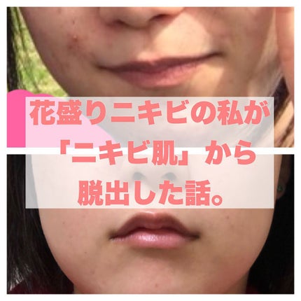 ミノン アミノモイスト モイストチャージ ミルク/ミノン/乳液を使ったクチコミ(1枚目)