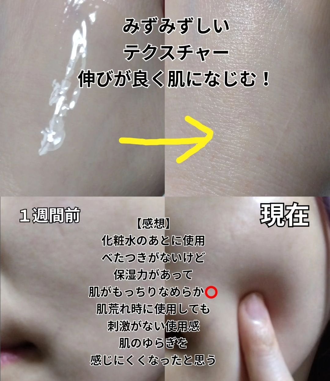 エイシカ365マイクロセラム/AESTURA/美容液を使ったクチコミ(3枚目)