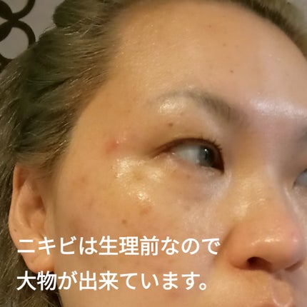 グローパックCL+/enisie/シートマスク・パックを使ったクチコミ(9枚目)