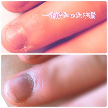 ネイルケアセット/無印良品/ネイル用品を使ったクチコミ(4枚目)