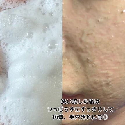 プレミアムもちソープ「グリーンアルティザン」/アレンシア/その他洗顔料を使ったクチコミ(4枚目)