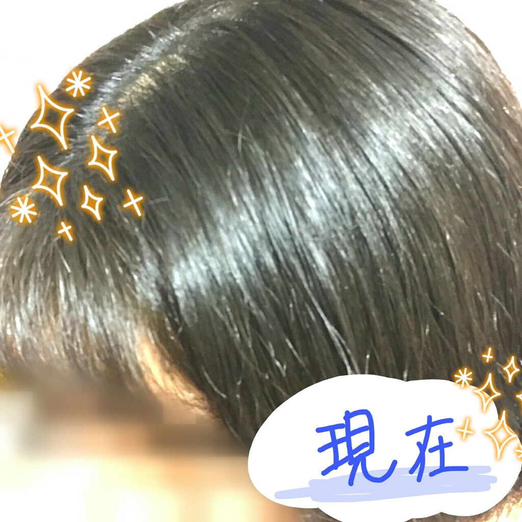 ハトムギ化粧水(ナチュリエ スキンコンディショナー R )/ナチュリエ/化粧水を使ったクチコミ（3枚目）