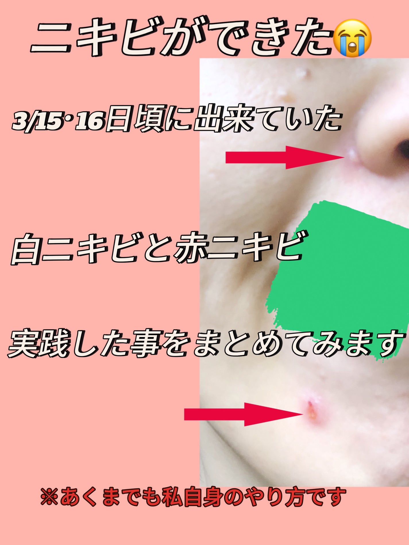 ハトムギ浸透乳液(ナチュリエ スキンコンディショニングミルク)/ナチュリエ/乳液を使ったクチコミ(1枚目)