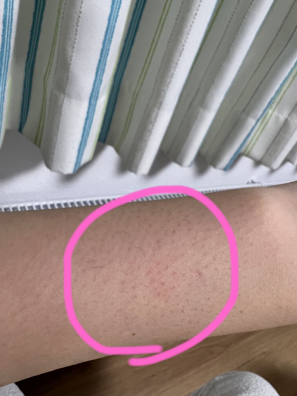 ミュゼコスメ メンズ 薬用ヘアリムーバルクリーム ホワイトシトラスの香り/ミュゼコスメ/除毛クリームを使ったクチコミ（3枚目）