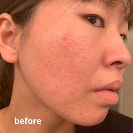 ã¯ã³ããŒãã«ãããã©ã¹ãã£ã³ã°ã¯ãã·ã§ã³/iâm meme/ã¯ãã·ã§ã³ãã¡ã³ããŒã·ã§ã³ã䜿ã£ãã¯ãã³ãïŒ7æç®ïŒ