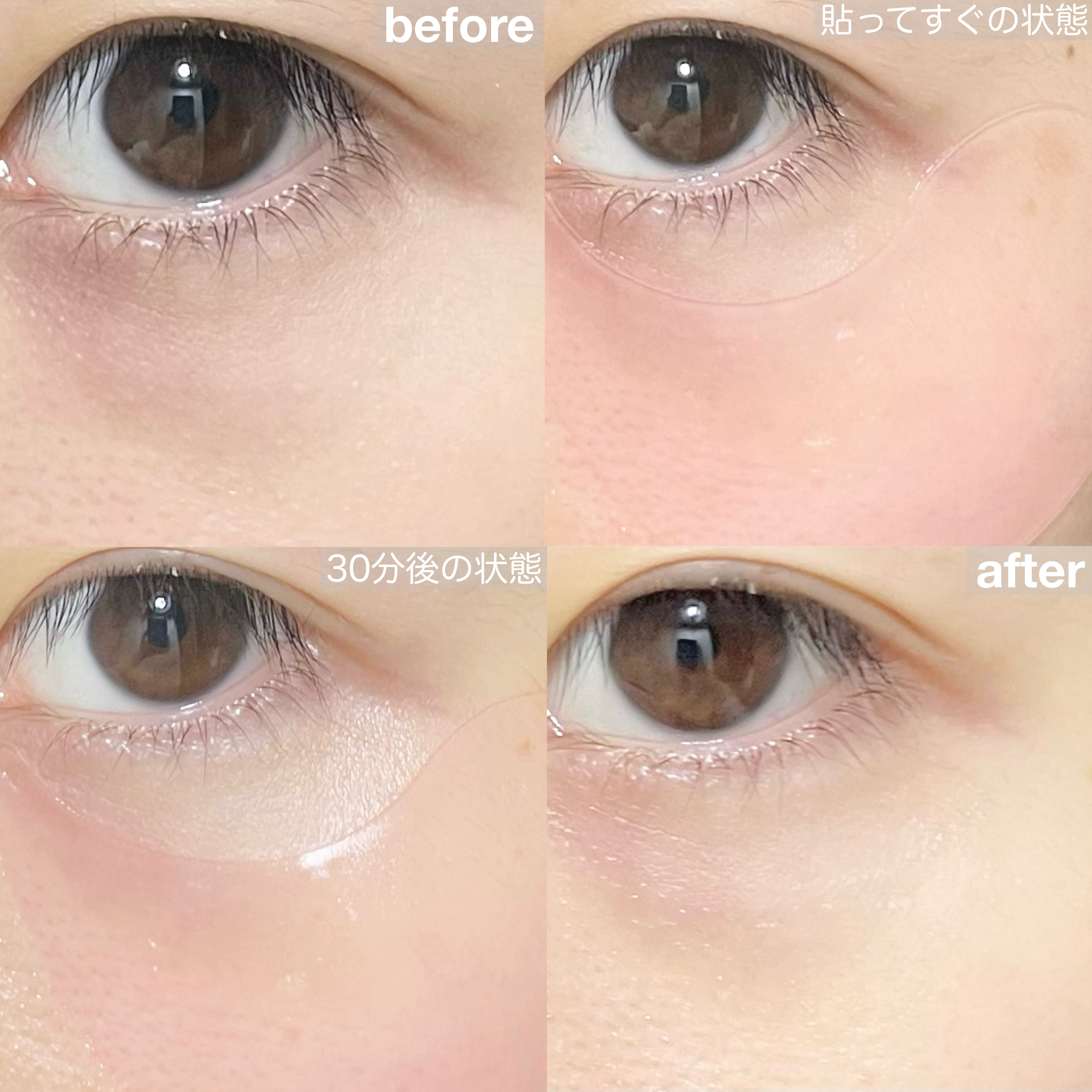 RXザ・ペプチドコラーゲン ハイドロゲルアイパッチ/COSRX/アイケア・アイクリームを使ったクチコミ（2枚目）