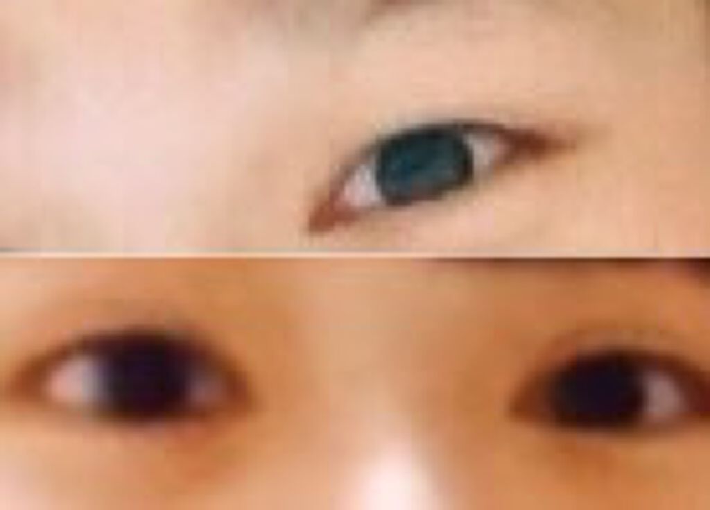 アイトーク/アイトーク/二重まぶた用アイテムを使ったクチコミ（3枚目）