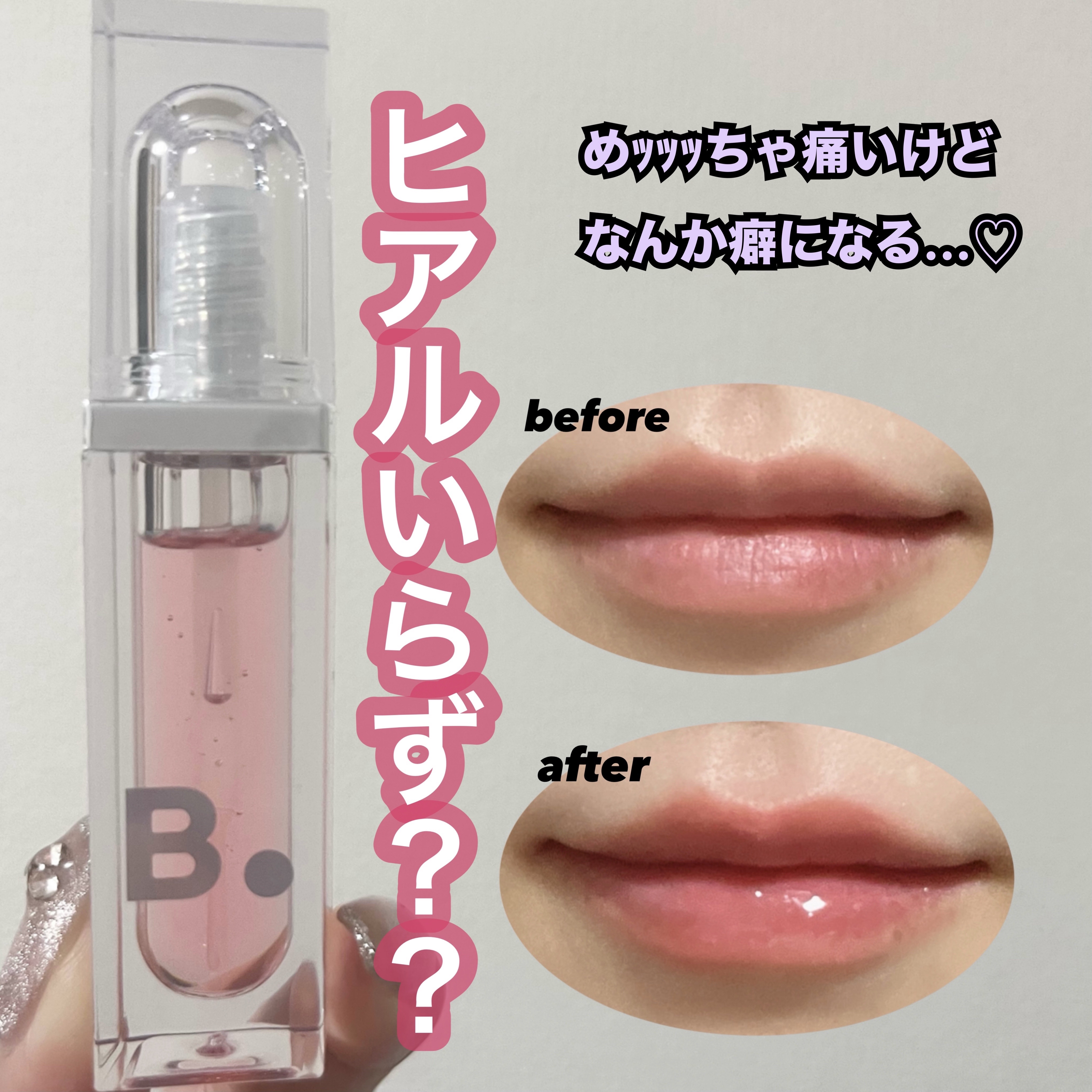 ボリュームリッププランパー 02 マキシ/BANILA CO/リッププランパーを使ったクチコミ（1枚目）