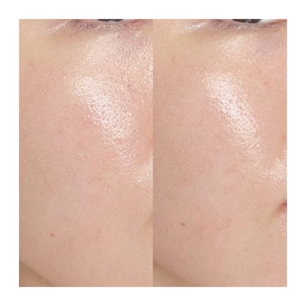 ピンクティーツリートナー/APLIN/化粧水を使ったクチコミ(3枚目)