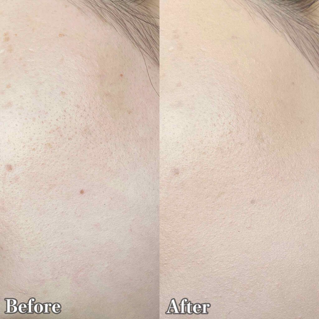 【旧】ディオールスキン フォーエヴァー スキン コレクト コンシーラー/Dior/リキッドコンシーラーを使ったクチコミ(3枚目)