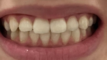 糸ようじ　やわらか歯間ブラシ/小林製薬/デンタルフロス・歯間ブラシを使ったクチコミ（1枚目）