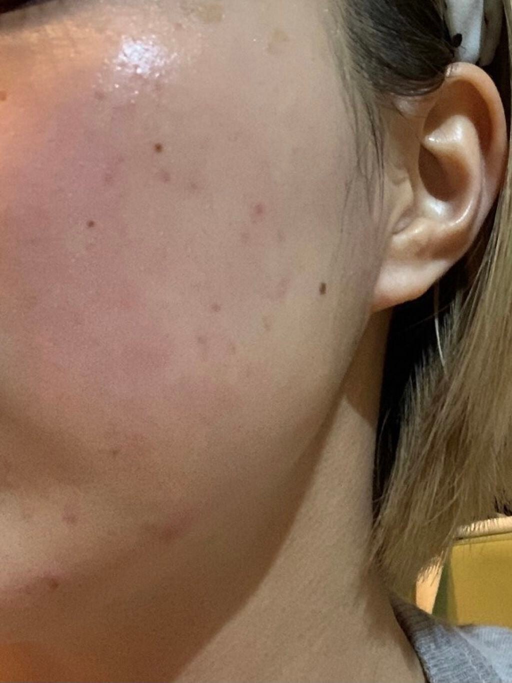 クリスタルパウダー/TOUT VERT/その他スキンケアを使ったクチコミ(2枚目)