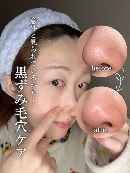 オリジナル ピュアスキンジェリー/ヴァセリン/ボディクリームを使ったクチコミ(1枚目)