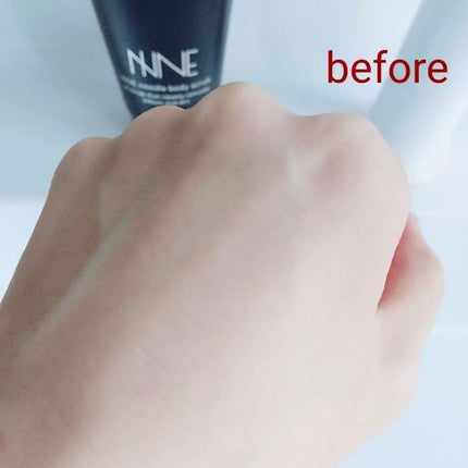 ニードルボディスクラブ/NNE/ボディスクラブを使ったクチコミ(6枚目)