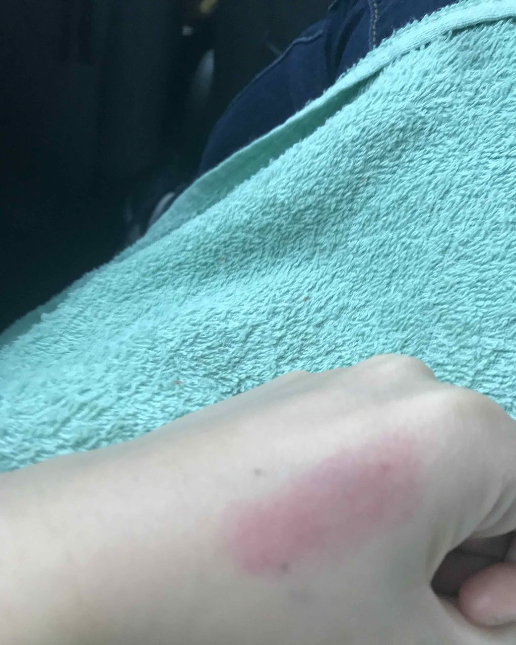 リップドレス/メンターム/リップクリームを使ったクチコミ(2枚目)