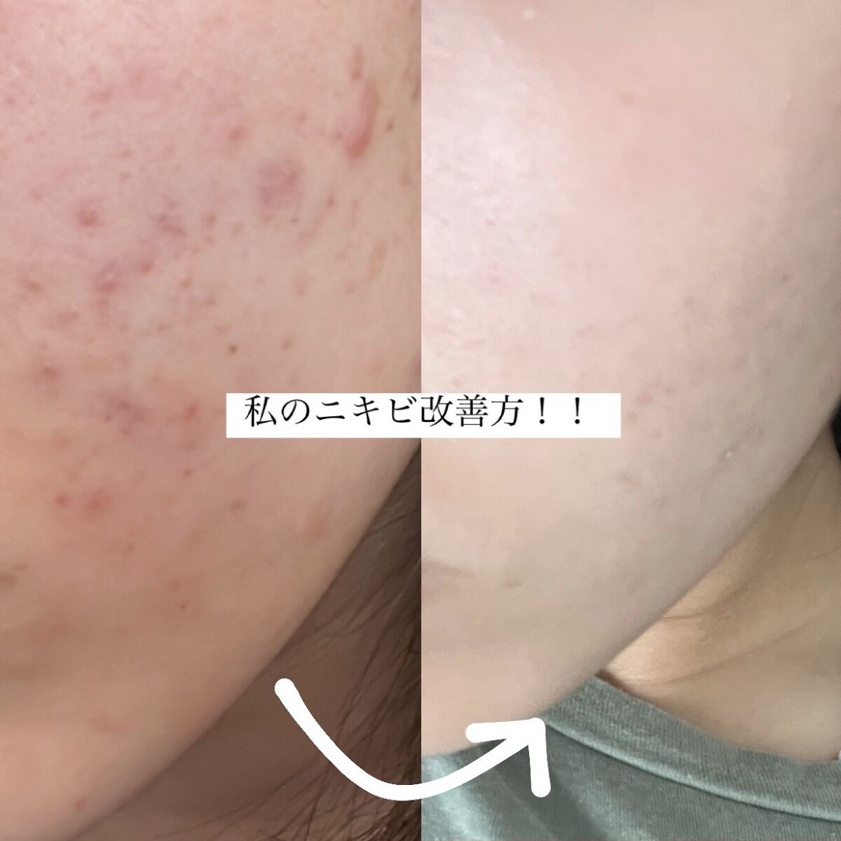 明色美顔水 薬用化粧水/美顔/化粧水を使ったクチコミ（1枚目）