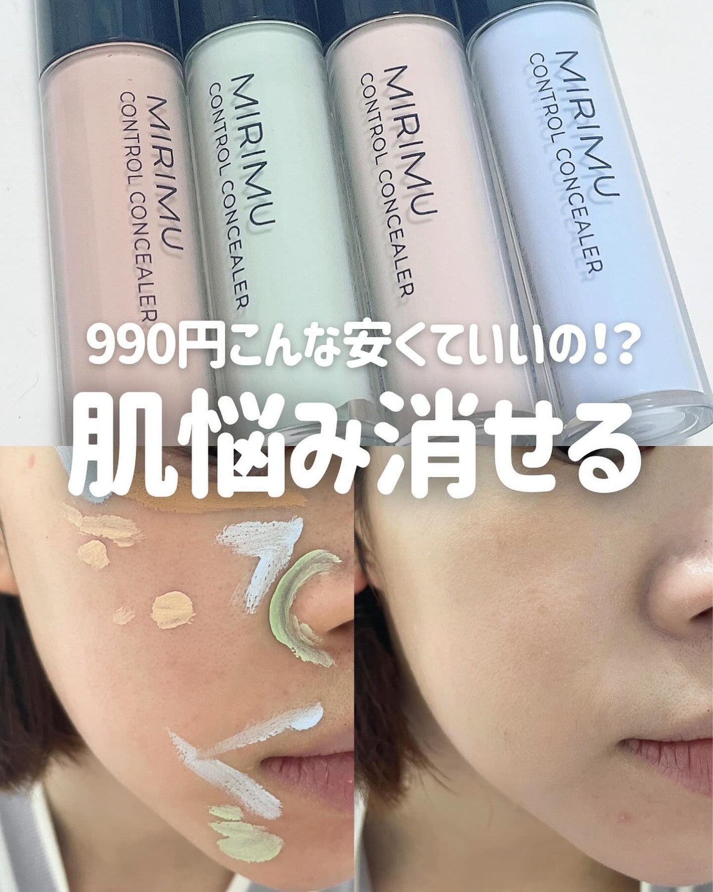 コントロールコンシーラー/MIRIMU/コンシーラーを使ったクチコミ(1枚目)