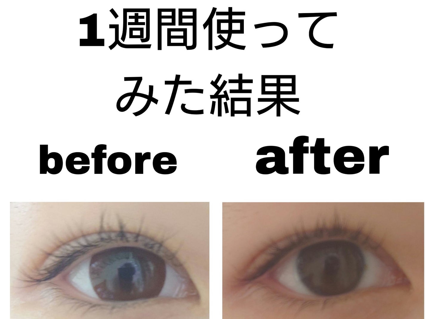 ナイトアイラッシュセラム/MATSUGE OMOI/美容液を使ったクチコミ(2枚目)