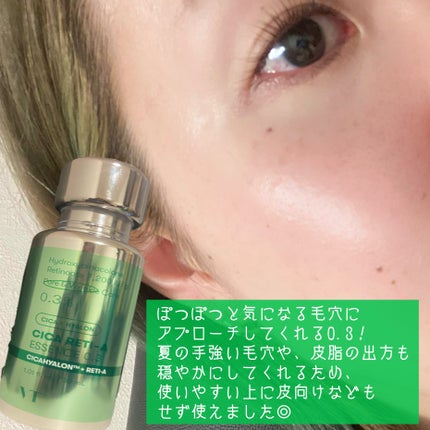 シカレチA エッセンス0.3/VT/美容液を使ったクチコミ(4枚目)