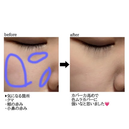 ダーマシンコンシーラー/23years old/リキッドコンシーラーを使ったクチコミ(3枚目)