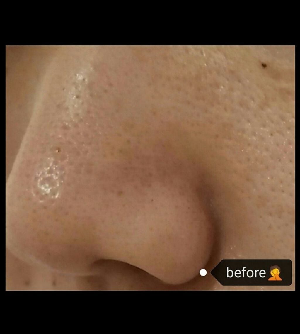 デュオ ザ クレンジングバーム クリア/DUO/クレンジングバームを使ったクチコミ(2枚目)